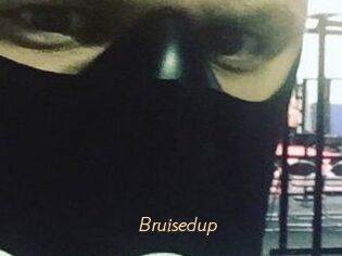 Bruisedup